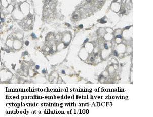 Polyclonal Rabbit anti-Human ABCF3 Antibody (IHC, WB)