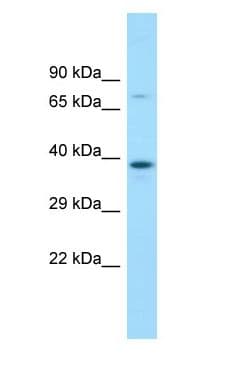Polyclonal Rabbit anti-Human MBIP Antibody (C-Terminus, WB)