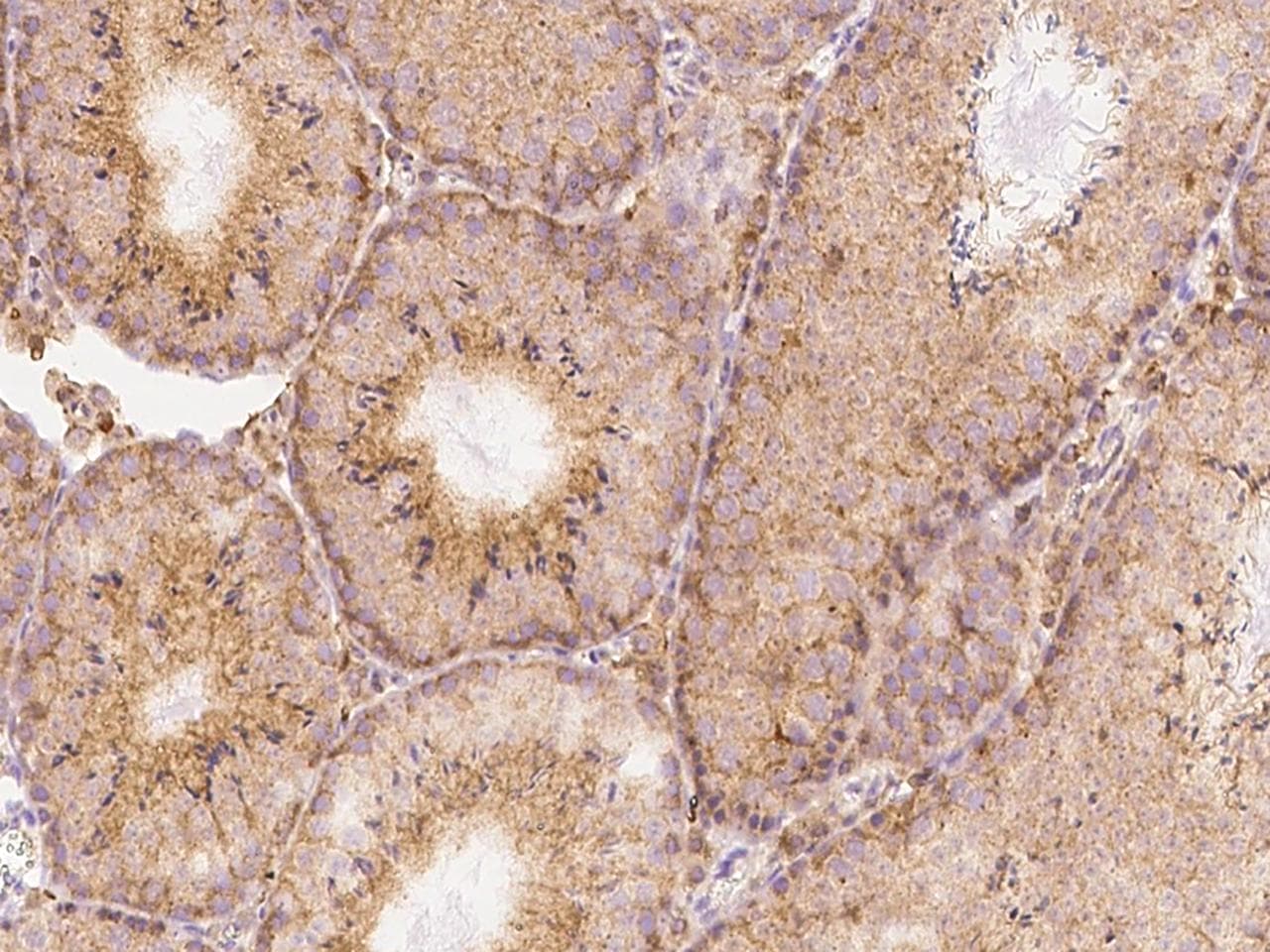IFN Gamma / Interferon Gamma Antibody (Preservative Free)