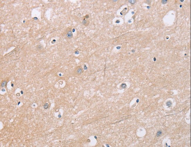 Polyclonal Rabbit anti-Human KLK4 / Kallikrein 4 Antibody (IHC)