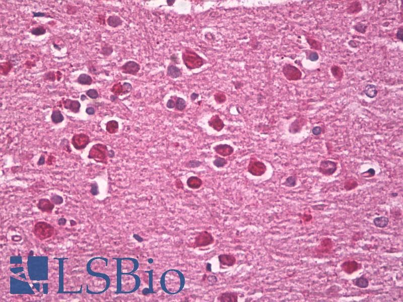 IHC-plus™ Neurofibromin / NF1 Antibody (aa27-41)