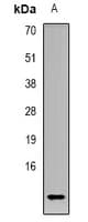 Polyclonal Rabbit anti-Human CCL4L1 Antibody (Internal, WB)