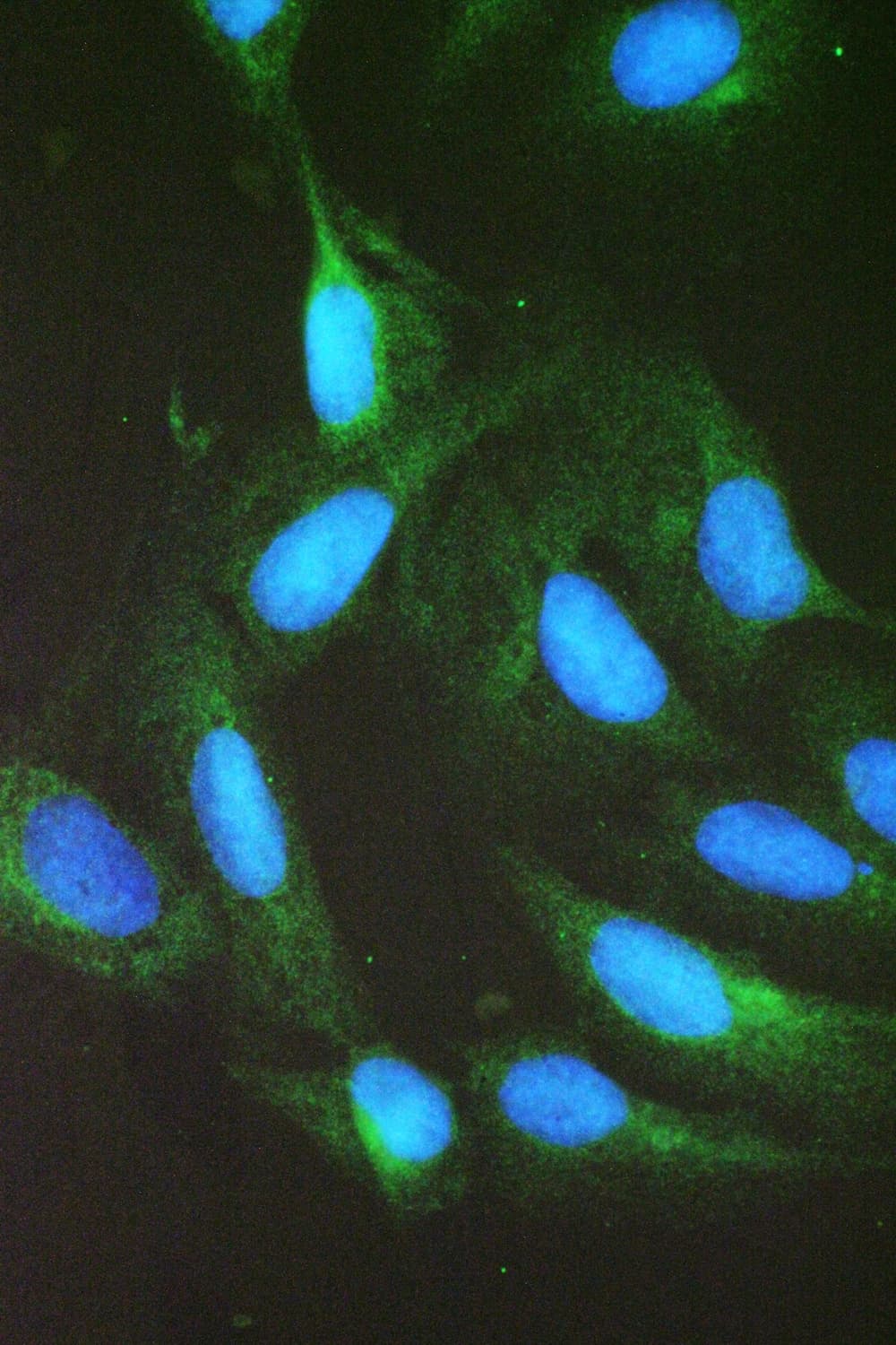 GSR / Glutathione Reductase Antibody