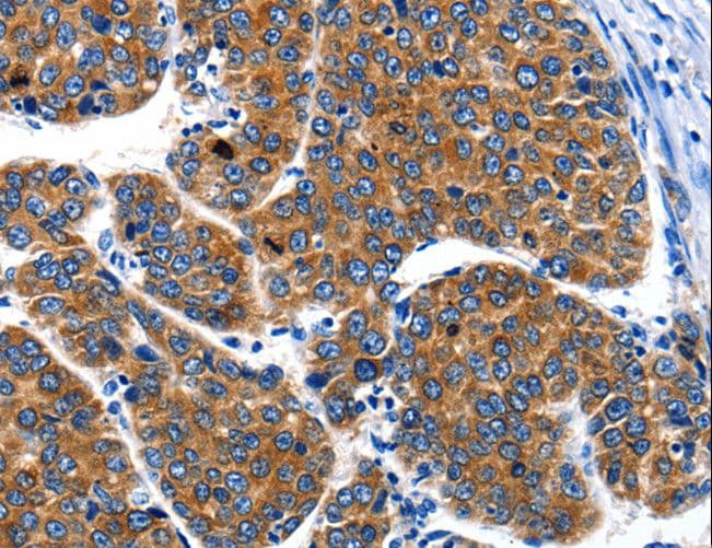 CRD-BP / ZBP1 / IGF2BP1 Antibody