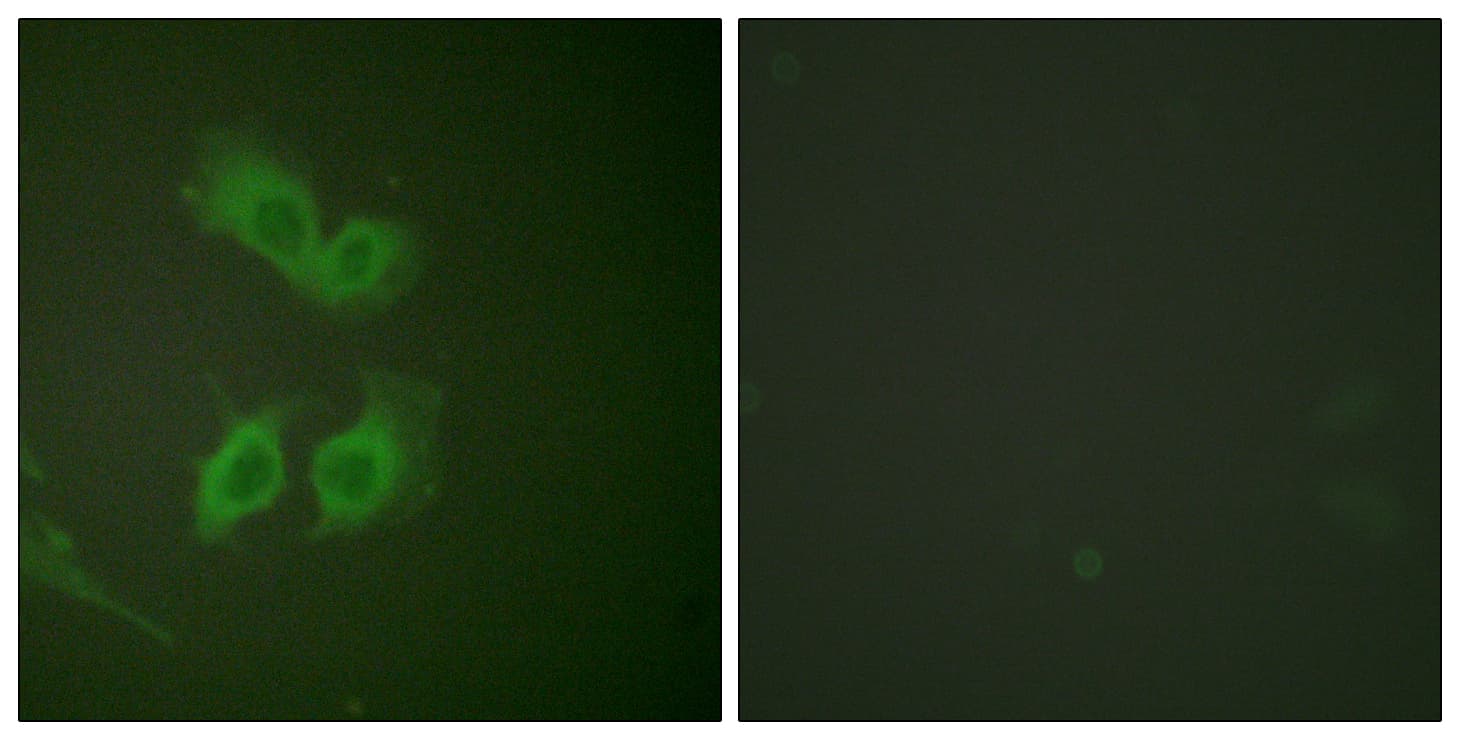Polyclonal Rabbit anti-Human Beta Amyloid Antibody (aa711-760, IHC, IF, WB)