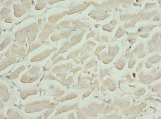 CFL2 / Cofilin 2 Antibody