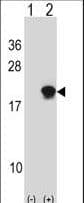 SUMO4 Antibody (Internal)