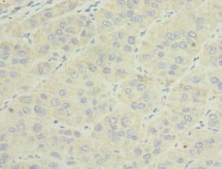 Polyclonal Rabbit anti-Human Osteoglycin / Mimecan Antibody (IHC)