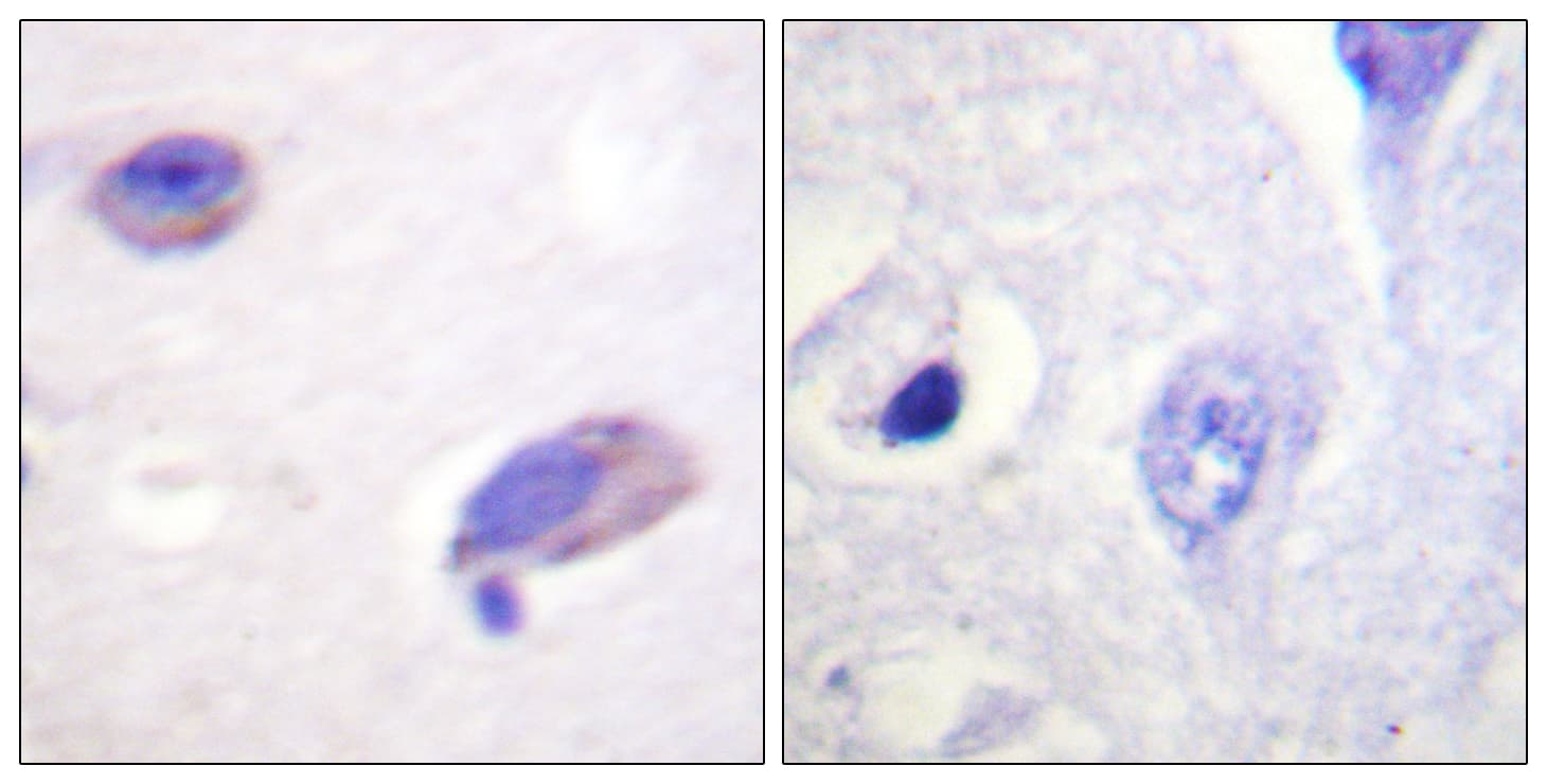FAK / Focal Adhesion Kinase Antibody (aa542-591)