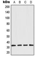 Polyclonal Rabbit anti-Human AQP3 / Aquaporin 3 Antibody (Internal, IHC, WB)