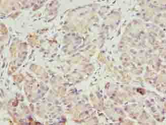 Polyclonal Rabbit anti-Human ERO1LB Antibody (IHC, WB)
