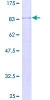 Human ERG1 / SQLE Protein (Recombinant GST)