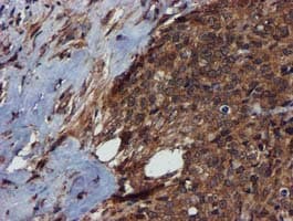 Complement C1s Antibody (clone OTI5F2)