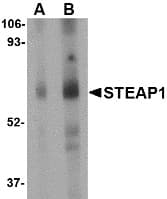 IHC-plus™ STEAP1 / STEAP Antibody (aa130-180)