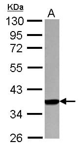 IHC-plus™ Polyclonal Rabbit anti-Human HLA-A Antibody (IHC, WB)