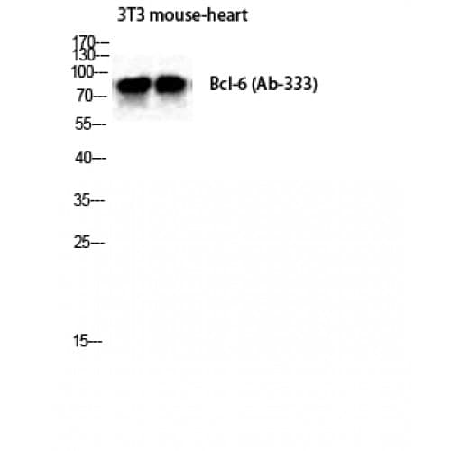 Polyclonal Rabbit anti-Human BCL6 Antibody (270-350 aa, IHC, WB)