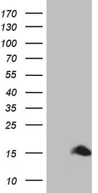 Monoclonal Mouse anti-Human S100A1 / S100-A1 Antibody (clone OTI7B11, IHC, WB)
