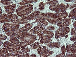 ACAA2 Antibody (clone OTI3H9)