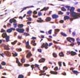 USP25 Antibody (aa1037-1068)