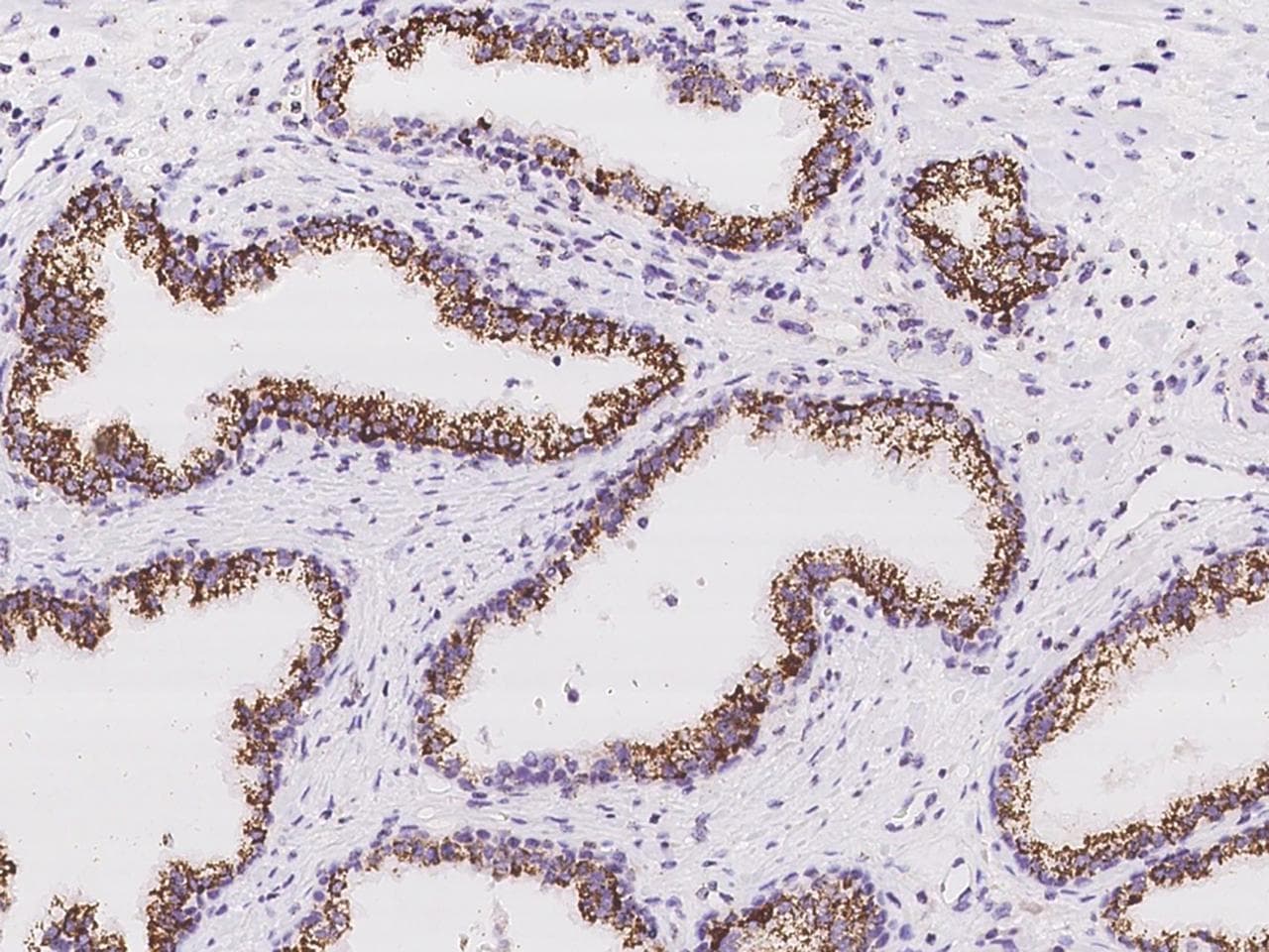 Polyclonal Rabbit anti-Human MYCT1 Antibody (IHC)