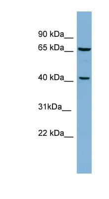 POLB / DNA Polymerase Beta Antibody (aa107-156)