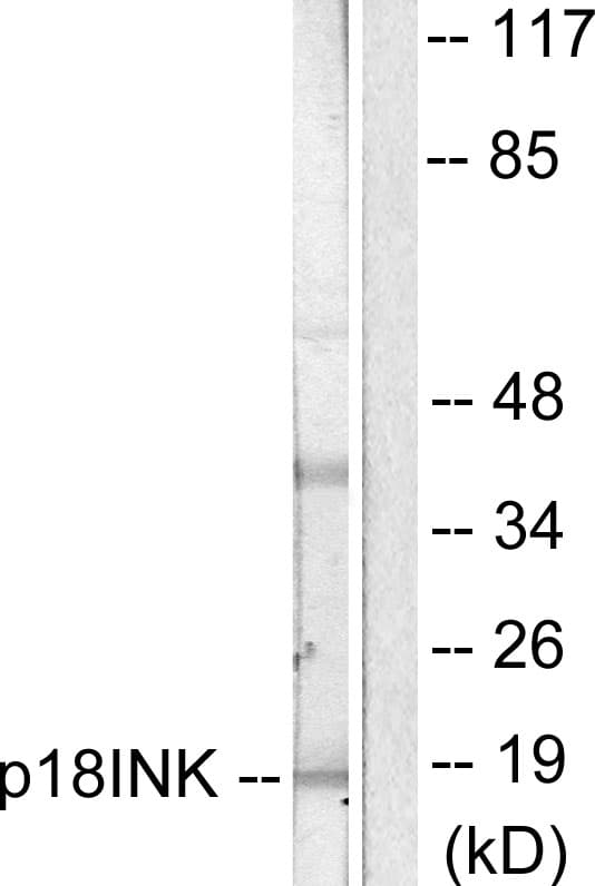 CDKN2C / p18 INK4c Antibody (aa111-160)