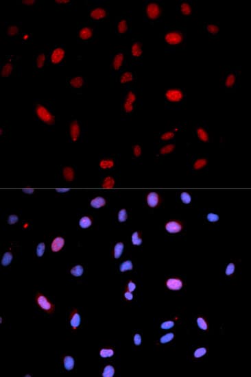 MAP2K6 / MEK6 / MKK6 Antibody (phospho-Ser207)