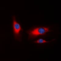 PAK1 Antibody (Internal)