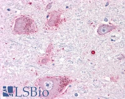 PathPlus™ CHRM3 / M3 Antibody (C-Terminus)