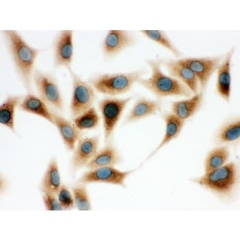COMT Antibody (aa52-271)