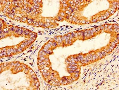 PROS1 / Protein S Antibody (aa42-676)