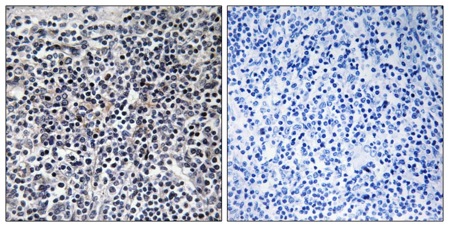 Polyclonal Rabbit anti-Human STMN1 / Stathmin / LAG Antibody (phospho-Ser15, IHC, IF, WB)