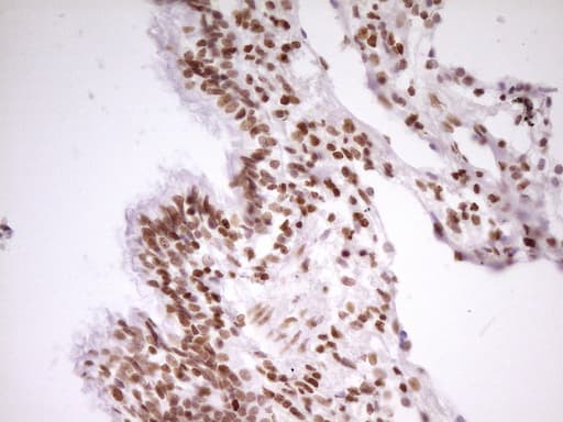Monoclonal Mouse anti-Human SP110 Antibody (clone OTI4C1, Carrier-free, aa232-521, IHC, WB)