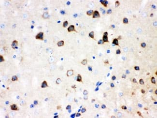 ABI1 / SSH3BP1 Antibody