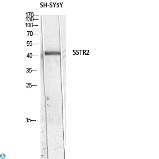 SSTR2 Antibody