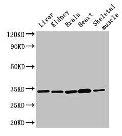 Polyclonal Rabbit anti-Human AHSA2 Antibody