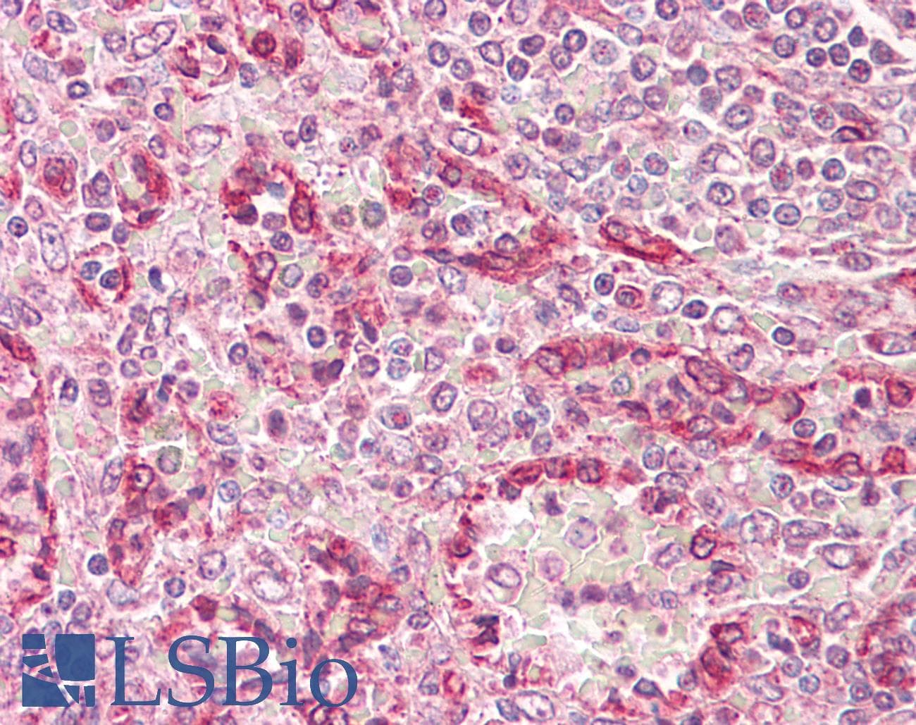 IHC-plus™ NAMPT / Visfatin Antibody (aa30-80)