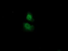 ADI1 / ARD Antibody (clone OTI3H6, Carrier-free)