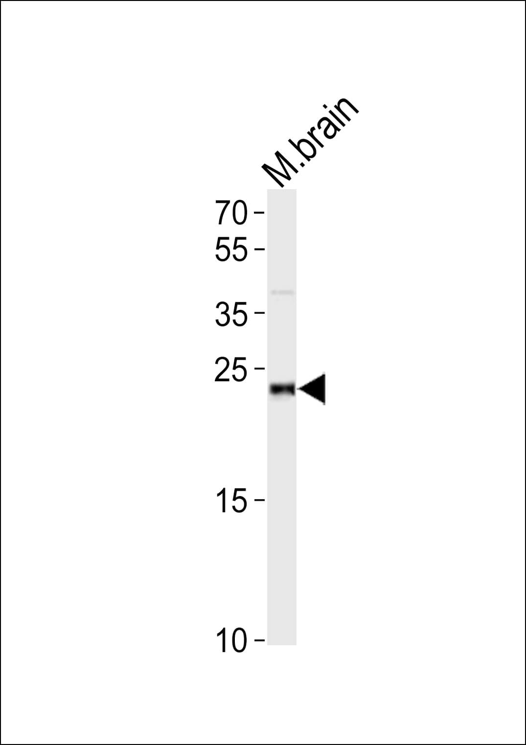 IHC-plus™ D52 / TPD52 Antibody (aa100-132)