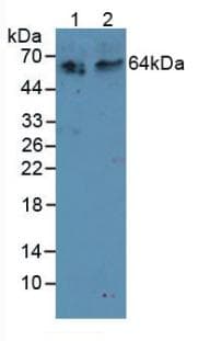 TNFRSF11A / RANK Antibody (aa31-214)