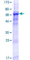 Human CENPL Protein (Recombinant GST)