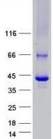 Human ACOT7 / BACH Protein (Recombinant Myc-DDK (Flag))