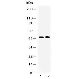 Polyclonal Rabbit anti-Human SERPINA5 / PCI Antibody (IHC, WB)