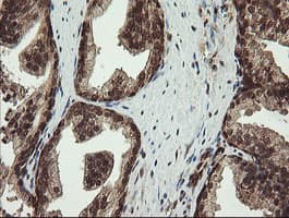 PROSC Antibody (clone OTI3A6, Carrier-free)