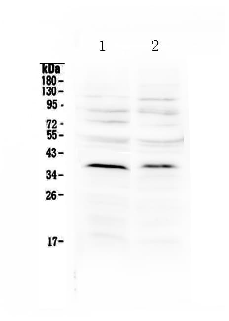 Polyclonal Rabbit anti-Human ATOH1 / MATH-1 Antibody (WB)