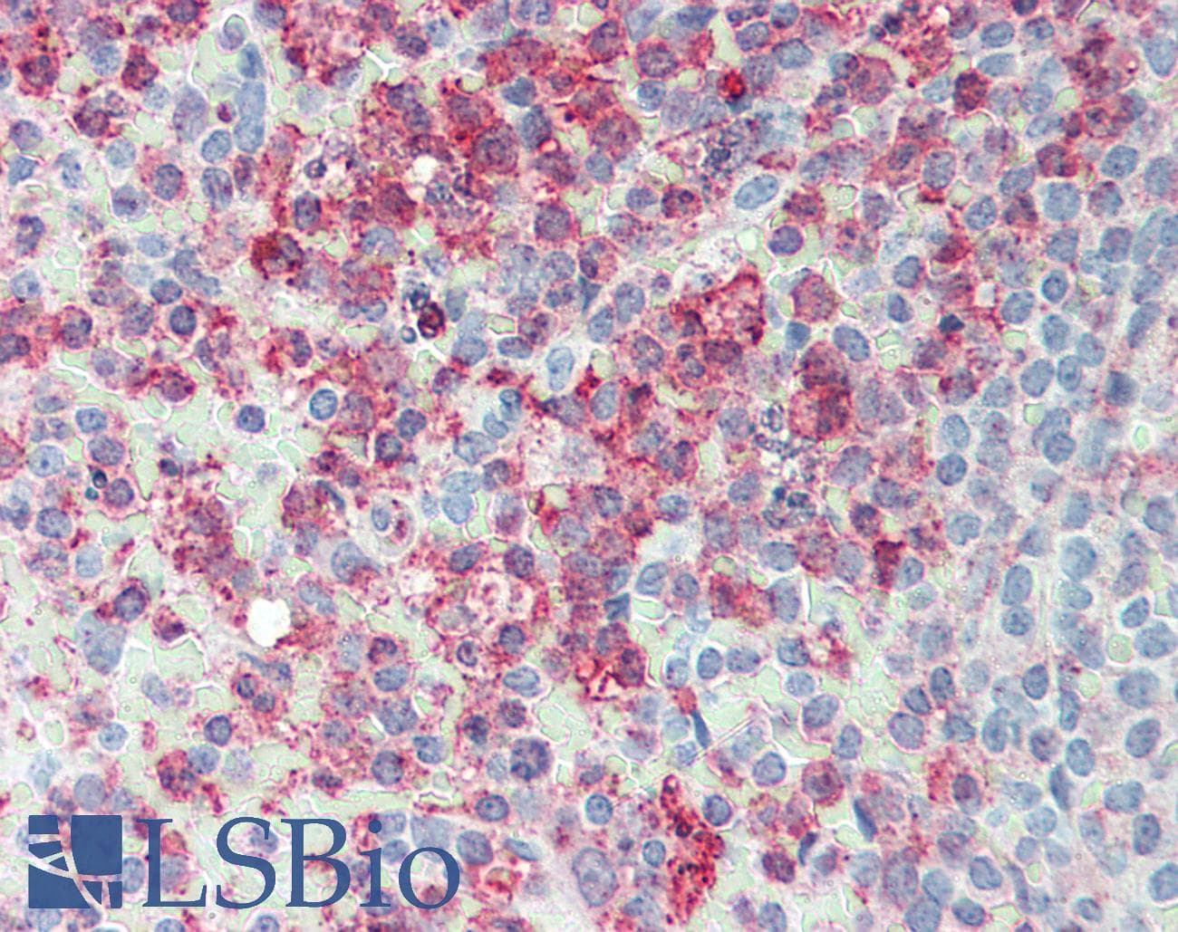IHC-plus™ Polyclonal Rabbit anti-Human ERMP1 Antibody (Internal, IHC)