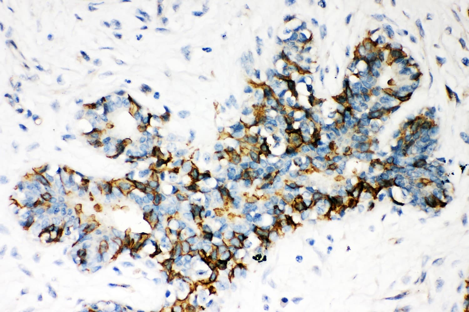 ABCB4 / MDR3 Antibody (aa601-720)