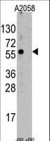 Polyclonal Rabbit anti-Human ST13 Antibody (aa50-80, IHC, WB)