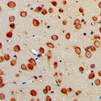 Polyclonal Rabbit anti-Human ARTS1 / ERAP1 Antibody (Internal, IHC, IF, WB)