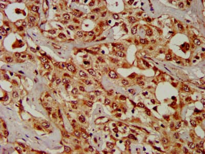 CPS1 Antibody